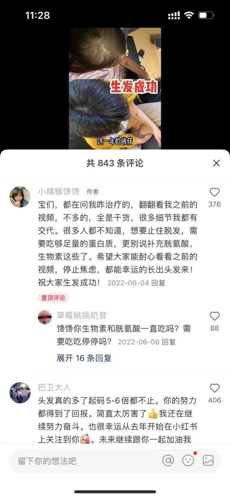 小红书如何赚钱（小红书“防秃”博主8万粉月销百万？） 9